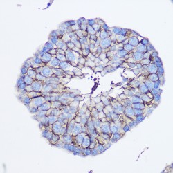5'-Nucleotidase / CD73 (NT5E) Antibody