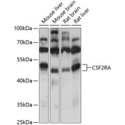 Western blot analysis of extracts of various cell lines using CSF2RA Antibody (1/500 dilution).