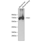 Western blot analysis of extracts of various cell lines using PCK1 Antibody.