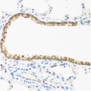Immunohistochemistry of paraffin-embedded Rat lung using CDKN2C Antibody (1/100 dilution, 40x lens).