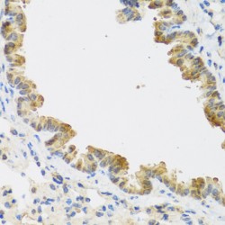Cyclin Dependent Kinase 4 Inhibitor C (CDKN2C) Antibody