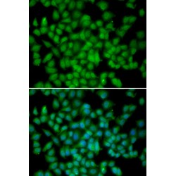 Cyclin Dependent Kinase 4 Inhibitor C (CDKN2C) Antibody