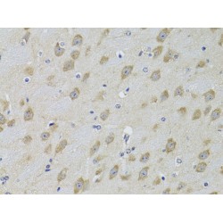 Adrenergic Receptor Beta Kinase 2 (ADRBK2) Antibody