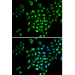 Runt Related Transcription Factor (RUNX1) Antibody
