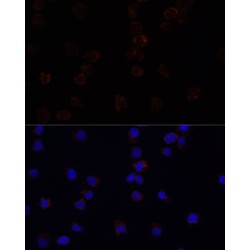 Myeloid Cell Surface Antigen CD33 (CD33) Antibody