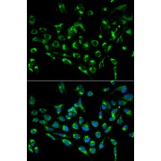 Immunofluorescence analysis of MCF-7 cells using CDKN3 Antibody