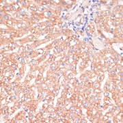 Immunohistochemistry of paraffin-embedded Rat liver using IKK alpha Antibody (1/100 dilution, 40x lens).