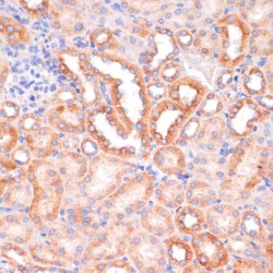 Inhibitor of Nuclear Factor Kappa-B Kinase Subunit Alpha / IKKA (CHUK) Antibody