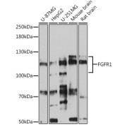 Western blot analysis of extracts of various cell lines using FGFR1 Antibody (1/500 dilution).