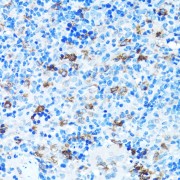 Immunohistochemistry of paraffin-embedded Rat spleen using FGFR2 Antibody (1/100 dilution, 40x lens).