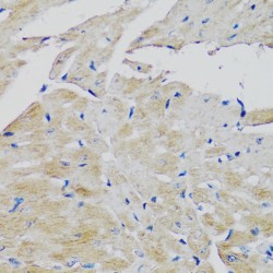 Fibroblast Growth Factor Receptor 2 (FGFR2) Antibody
