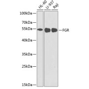Western blot analysis of extracts of various cell lines using FGR Antibody (1/1000 dilution).