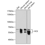 Western blot analysis of extracts of various cell lines using HCK Antibody (1/1000 dilution).