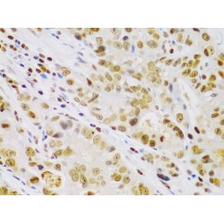 Inhibitor of Nuclear Factor Kappa-B Kinase Subunit Beta / IKKB (IKBKB) Antibody