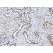 Immunohistochemistry of paraffin-embedded Rat kidney using ITGAV Antibody (1/50 dilution, 40x lens).