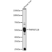 Western blot analysis of extracts of Mouse liver using TNFRSF11B Antibody (1/1000 dilution).