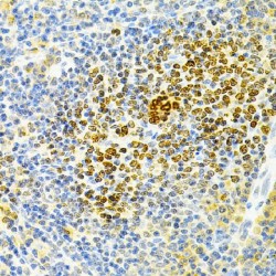 Tumor Necrosis Factor Receptor Superfamily Member 11B (TNFRSF11B) Antibody