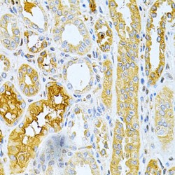Tumor Necrosis Factor Receptor Superfamily Member 11B (TNFRSF11B) Antibody