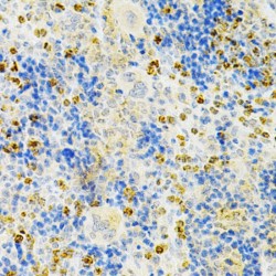 Tumor Necrosis Factor Receptor Superfamily Member 11B (TNFRSF11B) Antibody