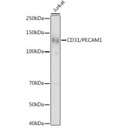 Western blot analysis of extracts of Jurkat cells using CD31/PECAM1 Antibody at cells using CD31/PECAM1 Antibody (1/1000 dilution).