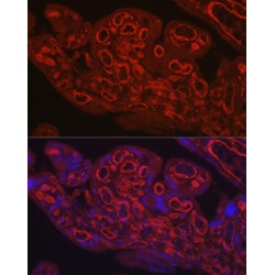 Platelet And Endothelial Cell Adhesion Molecule 1 (PECAM1) Antibody
