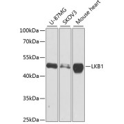 Western blot analysis of extracts of various cell lines using LKB1 Antibody (1/1000 dilution).