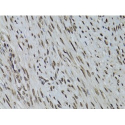 Serine/threonine-Protein Kinase STK11 (STK11) Antibody