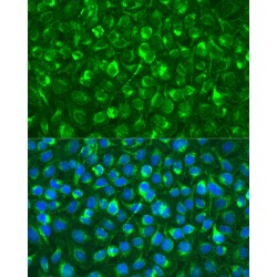 Spleen Associated Tyrosine Kinase (SYK) Antibody