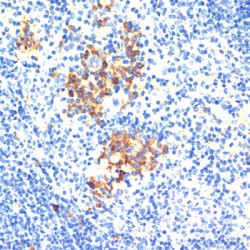 Thrombospondin 1 (THBS1) Antibody