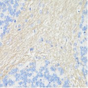 Immunohistochemistry of paraffin-embedded Rat brain using THY1 Antibody (1/100 dilution, 40x lens).