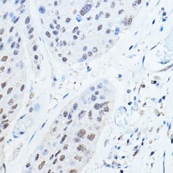 Polyubiquitin-B (UBB) Antibody