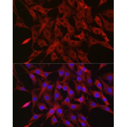 Polyubiquitin-B (UBB) Antibody