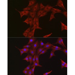Polyubiquitin-B (UBB) Antibody