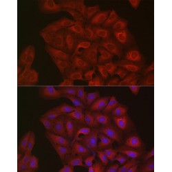 Polyubiquitin-B (UBB) Antibody