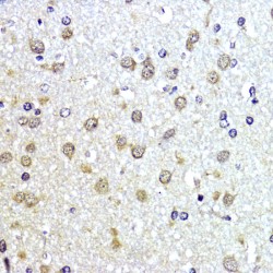 Small Ubiquitin Related Modifier Protein 1 (SUMO1) Antibody