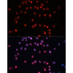 Small Ubiquitin Related Modifier Protein 1 (SUMO1) Antibody