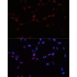 Small Ubiquitin Related Modifier Protein 1 (SUMO1) Antibody