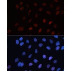 Small Ubiquitin Related Modifier Protein 1 (SUMO1) Antibody
