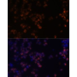 Zyxin (ZYX) Antibody