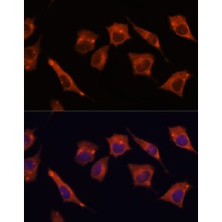 Mucosa-Associated Lymphoid Tissue Lymphoma Translocation Protein 1 (MALT1) Antibody