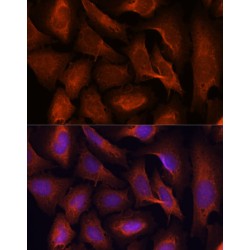 Mucosa-Associated Lymphoid Tissue Lymphoma Translocation Protein 1 (MALT1) Antibody