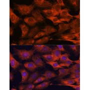 Immunofluorescence analysis of C6 cells using MALT1 Antibody (1/100 dilution). Blue: DAPI for nuclear staining.