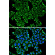 Immunofluorescence analysis of MCF-7 cells using REG3G Antibody
