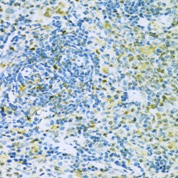 Caspase 3 (CASP3) Antibody
