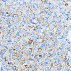 Aromatase (CYP19A1) Antibody