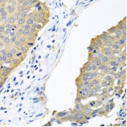 abx001774