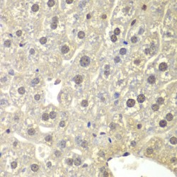 Nuclear Receptor Subfamily 3, Group C, Member 1 (Glucocorticoid Receptor) (NR3C1) Antibody