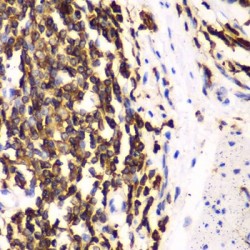 Hematopoietic Lineage Cell-Specific Protein (HCLS1) Antibody