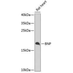 Natriuretic Peptides B (NPPB) Antibody
