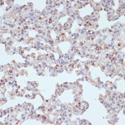 Immunohistochemistry of paraffin-embedded Rat lung using PDGFR beta Antibody (1/100 dilution, 40x lens).